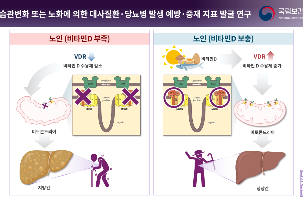 비타민 D, 노인성 지방간 예방의 새로운 희망 게시물 첨부 이미지